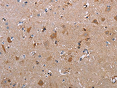 The image on the left is immunohistochemistry of paraffin-embedded Human brain tissue using CSB-PA272625(MAGEF1 Antibody) at dilution 1/30, on the right is treated with synthetic peptide. (Original magnification: ×200)