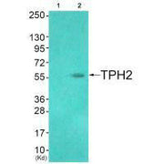 Western blot analysis of extracts from HuvEc cells (Lane 2), using TPH2 (Ab-19) antiobdy. The lane on the left is treated with systhesized peptide.