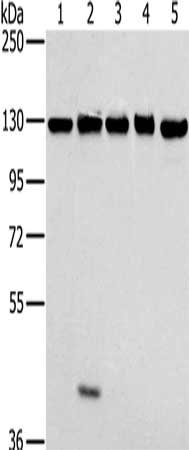 Gel: 6%SDS-PAGE, Lysate: 40 ug, Lane 1-5: NIH/3T3 cells, 231 cells, hela cells, K562 cells, 293T cells, Primary antibody: CSB-PA272764(MATR3 Antibody) at dilution 1/400, Secondary antibody: Goat anti rabbit IgG at 1/8000 dilution, Exposure time: 3...