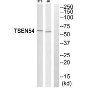 Western blot analysis of extracts from 3T3 cells and Jurkat cells, using TSEN54 antibody.