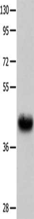 Gel: 10%SDS-PAGE, Lysate: 60 ug, Lane: Human fetal muscle tissue, Primary antibody: CSB-PA272813(UTS2R Antibody) at dilution 1/400, Secondary antibody: Goat anti rabbit IgG at 1/8000 dilution, Exposure time: 30 seconds