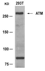 Western blot analysis of extracts from 293T cells using ATM(Ab-1981) Antibody and the same antibody preincubated with blocking peptide.