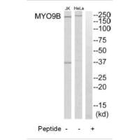 Western blot analysis of extracts from HeLa cells and Jurkat cells, using MYO9B antibody.