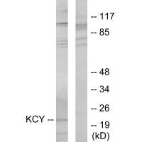 Western blot analysis of extracts from HeLa cells, using KCY antibody.