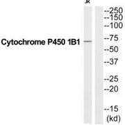 Western blot analysis of extracts from Jurkat cells, using CP1B1 antibody.