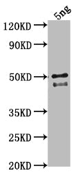 Western Blot Positive WB detected in Recombinant protein All lanes: DGAT3 antibody at 1:2000 Secondary Goat polyclonal to rabbit IgG at 1/50000 dilution Predicted band size: 43.2 kDa Observed band size: 44 kDa