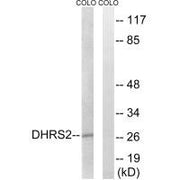 Western blot analysis of extracts from COLO cells, using DHRS2 antibody.