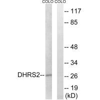 Western blot analysis of extracts from COLO cells, using DHRS2 antibody.