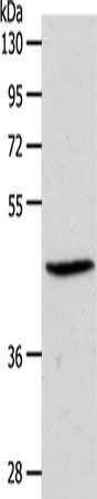 Gel: 10%SDS-PAGE, Lysate: 50 ug, Lane: PC3 cells, Primary antibody: CSB-PA273834(S1PR3 Antibody) at dilution 1/550, Secondary antibody: Goat anti rabbit IgG at 1/8000 dilution, Exposure time: 20 seconds