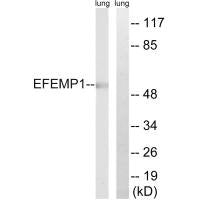 Western blot analysis of extracts from rat lung cells, using EFEMP1 antibody.