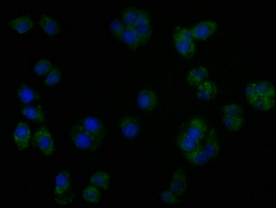 Immunofluorescence staining of PC3 cells with CSB-PA27472A0Rb at 1:50, counter-stained with DAPI. The cells were fixed in 4% formaldehyde, permeabilized using 0.2% Triton X-100 and blocked in 10% normal Goat Serum. The cells were then incubated wi...