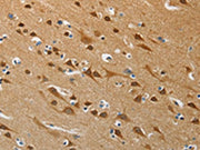 The image on the left is immunohistochemistry of paraffin-embedded Human brain tissue using CSB-PA274804(ATG4B Antibody) at dilution 1/50, on the right is treated with synthetic peptide. (Original magnification: ×200)