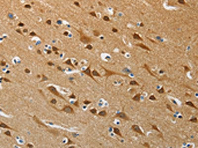 The image on the left is immunohistochemistry of paraffin-embedded Human brain tissue using CSB-PA274804(ATG4B Antibody) at dilution 1/50, on the right is treated with synthetic peptide. (Original magnification: ×200)