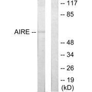 Western blot analysis of extracts from 293 cells, using AIRE antibody.