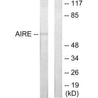 Western blot analysis of extracts from 293 cells, using AIRE antibody.