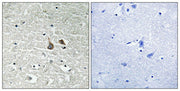 Immunohistochemical analysis of paraffin-embedded human brain tissue using IRAK1 (Phospho-Ser376) antibody (left)or the same antibody preincubated with blocking peptide (right).