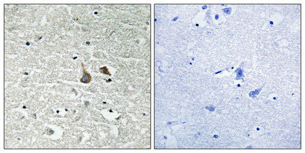 Immunohistochemical analysis of paraffin-embedded human brain tissue using IRAK1 (Phospho-Ser376) antibody (left)or the same antibody preincubated with blocking peptide (right).