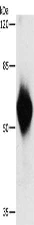 Gel: 8%SDS-PAGE, Lysate: 2 ug, Lane: Recombinant HA tagged protein, Primary antibody: CSB-PA275079(HA Tag Antibody) at dilution 1/500, Secondary antibody: Goat anti rabbit IgG at 1/8000 dilution, Exposure time: 1 second