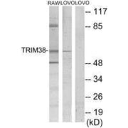 Western blot analysis of extracts from RAW264.7 cells and LOVO cells, using TRIM38 antibody.