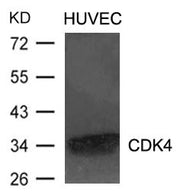 Western blot analysis of extracts from HUVEC cells using CDK4 Antibody.