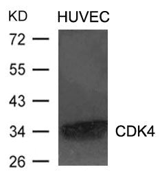 Western blot analysis of extracts from HUVEC cells using CDK4 Antibody.