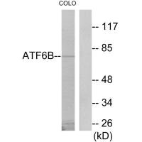 Western blot analysis of extracts from COLO205 cells, using ATF6B antibody.