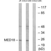Western blot analysis of extracts from Jurkat cells and COLO cells, using MED18 antibody.