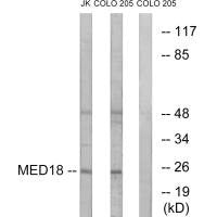 Western blot analysis of extracts from Jurkat cells and COLO cells, using MED18 antibody.