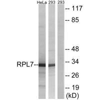 Western blot analysis of extracts from HepG2 cells and Jurkat cells, using RPL5 antibody.