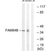 Western blot analysis of extracts from Jurkat cells and HUVEC cells, using FAM84B antibody.