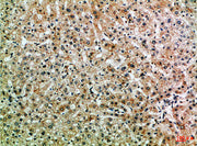 Immunohistochemical analysis of paraffin-embedded Human-liver, antibody was diluted at 1:100