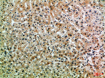 Immunohistochemical analysis of paraffin-embedded Human-liver, antibody was diluted at 1:100