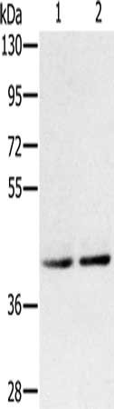 Gel: 8%SDS-PAGE, Lysate: 40 ug, Lane 1-2: K562 cells, Jurkat cells, Primary antibody: CSB-PA276368(DPF2 Antibody) at dilution 1/400, Secondary antibody: Goat anti rabbit IgG at 1/8000 dilution, Exposure time: 1 minute