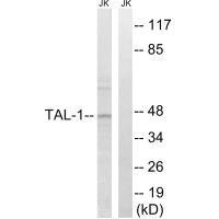 Western blot analysis of extracts from Jurkat cells, treated with PMA (125ng/ml, 30mins), using TAL-1 (Ab-122) antibody.