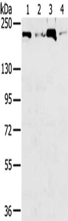 Gel: 6%SDS-PAGE, Lysate: 40 ug, Lane 1-4: Raw264.7, Jurkat cells, K562 cells, hepg2 cells, Primary antibody: CSB-PA276513(TOP2B Antibody) at dilution 1/250, Secondary antibody: Goat anti rabbit IgG at 1/8000 dilution, Exposure time: 40 seconds