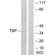 Western blot analysis of extracts from 293 cells, using TBP antibody.