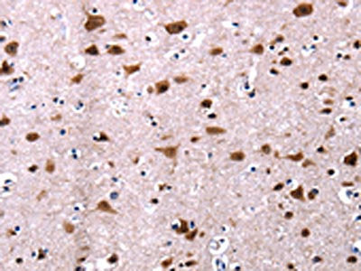 The image on the left is immunohistochemistry of paraffin-embedded Human brain tissue using CSB-PA276737(CSNK2A1 Antibody) at dilution 1/13, on the right is treated with fusion protein. (Original magnification: ×200)