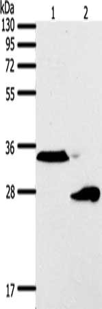 Gel: 12%SDS-PAGE, Lysate: 50 ug, Lane 1-2: A549 cells, human fetal lung tissue, Primary antibody: CSB-PA276859(SFTPA1 Antibody) at dilution 1/300, Secondary antibody: Goat anti rabbit IgG at 1/8000 dilution, Exposure time: 1 minute