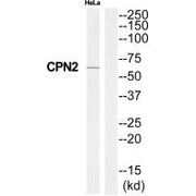 Western blot analysis of extracts from HeLa cells, using CPN2 antibody.