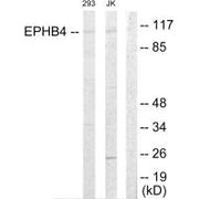 Western blot analysis of extracts from 293 cells and Jurkat cells, using EPHB4 antibody.