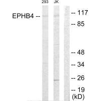 Western blot analysis of extracts from 293 cells and Jurkat cells, using EPHB4 antibody.