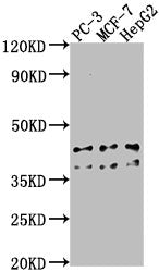 Western Blot Positive WB detected in: PC-3 whole cell lysate, MCF-7 whole cell lysate, HepG2 whole cell lysate All lanes: RHBDD3 antibody at 1:1000 Secondary Goat polyclonal to rabbit IgG at 1/50000 dilution Predicted band size: 41 kDa Observed ba...