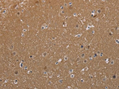 The image on the left is immunohistochemistry of paraffin-embedded Human brain tissue using CSB-PA277591(MAGEL2 Antibody) at dilution 1/40, on the right is treated with synthetic peptide. (Original magnification: ×200)