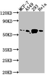 Western Blot Positive WB detected in: MCF-7 whole cell lysate, A549 whole cell lysate, 293 whole cell lysate, Hela whole cell lysate All lanes: PDE1B antibody at 1:1000 Secondary Goat polyclonal to rabbit IgG at 1/50000 dilution Predicted band siz...