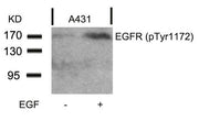 Western blot analysis of extracts from A431 cells untreated or treated with EGF using EGFR(Phospho-Tyr1172) Antibody.