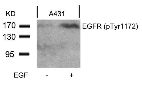 Western blot analysis of extracts from A431 cells untreated or treated with EGF using EGFR(Phospho-Tyr1172) Antibody.