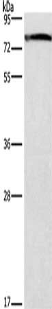 Gel: 8%SDS-PAGE, Lysate: 40 ug, Lane: Mouse brain tissue, Primary antibody: CSB-PA277712(GALC Antibody) at dilution 1/300, Secondary antibody: Goat anti rabbit IgG at 1/8000 dilution, Exposure time: 1 minute