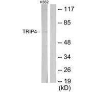 Western blot analysis of extracts from K562 cells, using TRIP4 antibody.