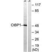 Western blot analysis of extracts from Jurkat cells, using CtBP1 (Ab-422) antibody.