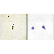 Immunohistochemistry analysis of paraffin-embedded human brain tissue, using ICK antibody.
